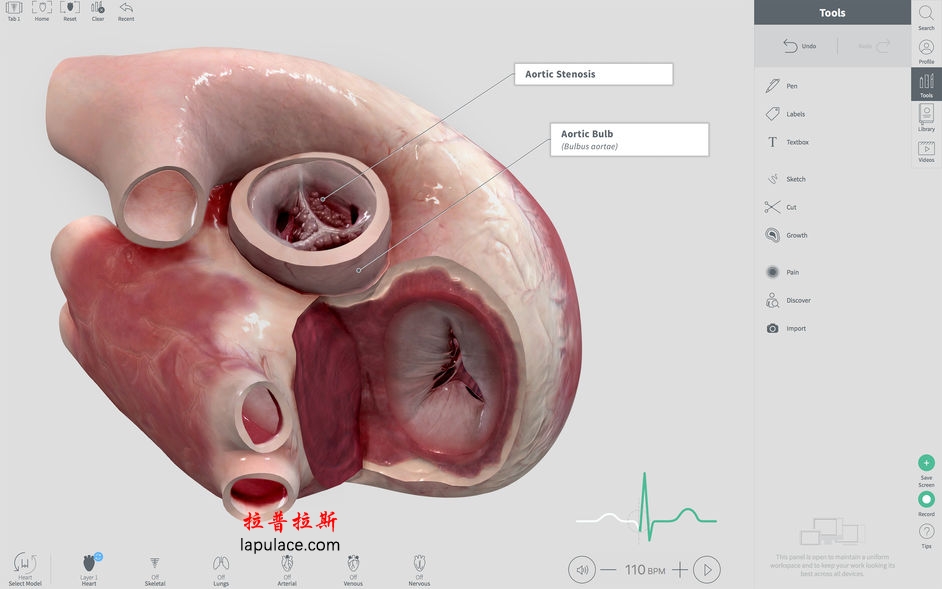 Complete Heart for Mac 1.2 3D心脏解剖图 破解版下载