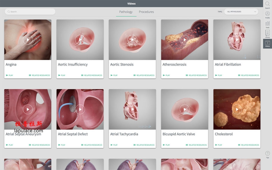 Complete Heart for Mac 1.2 3D心脏解剖图 破解版下载